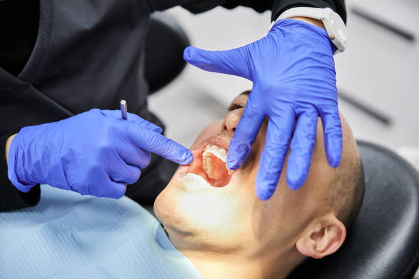 Best Emergency Wisdom Teeth Removal in Van, TX