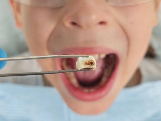 Best Emergency Dental Surgery in Van, TX